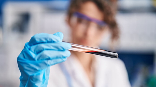 Создан тест, точно выявляющий рак поджелудочной на ранней стадии