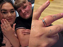 Британке едва не ампутировали палец из-за слишком маленького помолвочного кольца