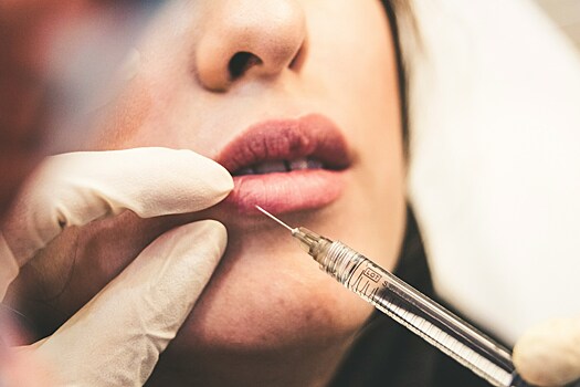 Врач развеяла наиболее распространенные мифы о ботоксе и филлерах