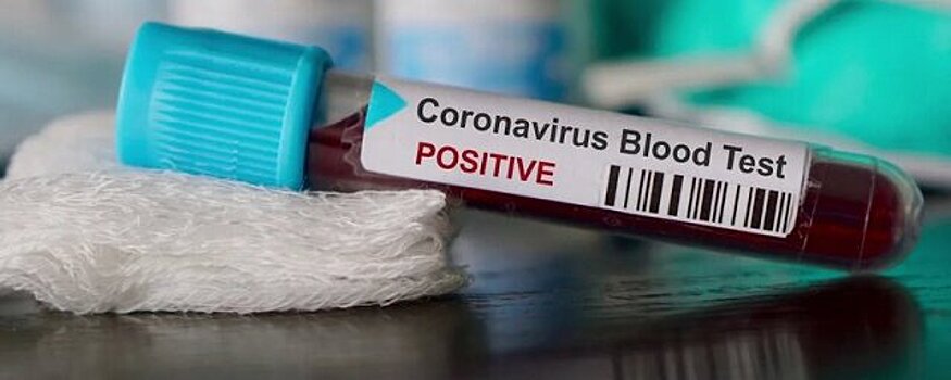 Сахалинцы вынуждены ждать результатов ПЦР-теста на ковид по восемь дней