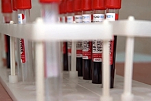 В РФ ответили на призыв отложить регистрацию вакцины