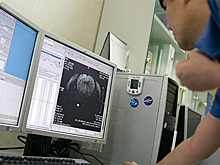 Провалы в памяти могут возникать из-за подавления воспоминаний