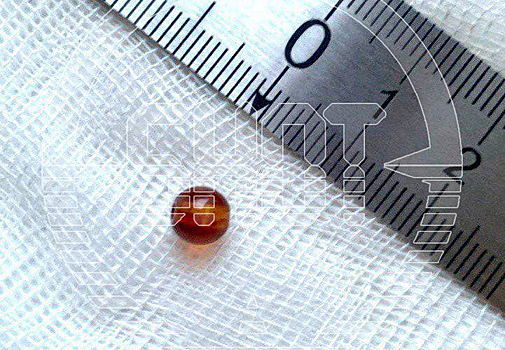 Жительница Подмосковья 76 лет проходила с бусиной внутри уха