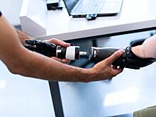 Лишившийся рук подросток-стример получил крутые протезы