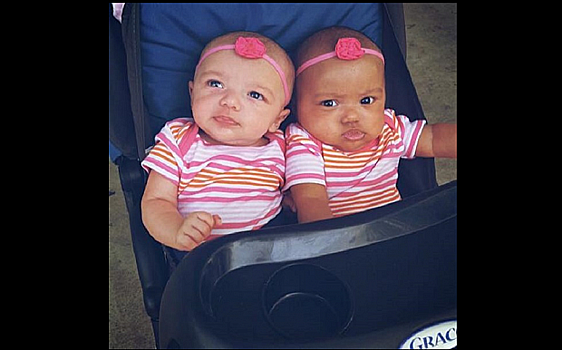 В США родились разноцветные близнецы