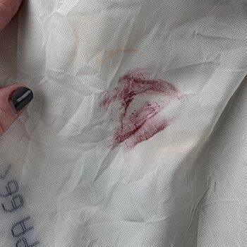 Неубиваемая помада. Девушка пережила ДТП, не испортив макияжа