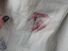 Неубиваемая помада. Девушка пережила ДТП, не испортив макияжа