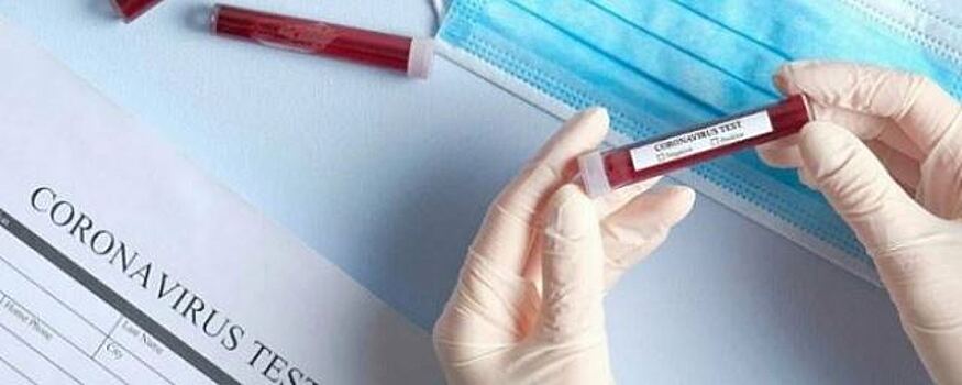 В Ростовской области выявлено 366 случаев коронавируса за сутки
