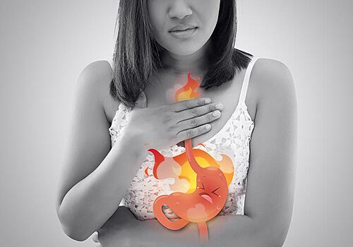 Что нужно знать об изжоге