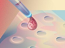 Создан новый инструмент для диагностики аутоиммунных заболеваний