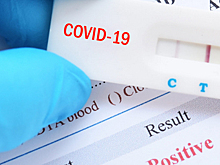 На Кипре изменили правила въезда для туристов