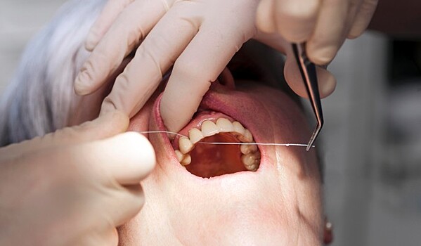 Раскрыта опасность зубной нити