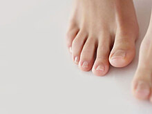 Почему желтеют ногти на ногах: 7 неочевидных причин