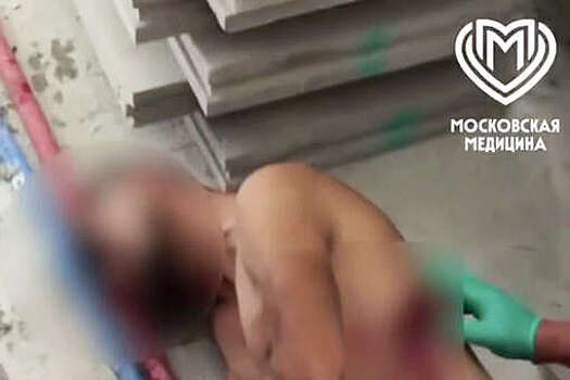 В Москве врачи спасли маляра, упавшего со строительных лесов