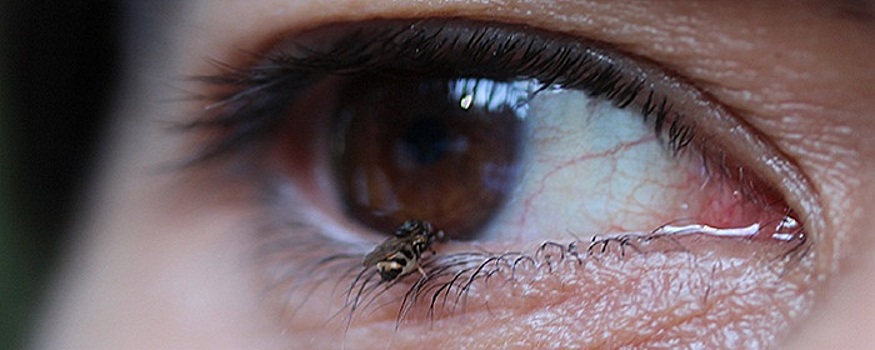 Офтальмолог Степанова рассказала, как распознать, что человек заражен глазными паразитами