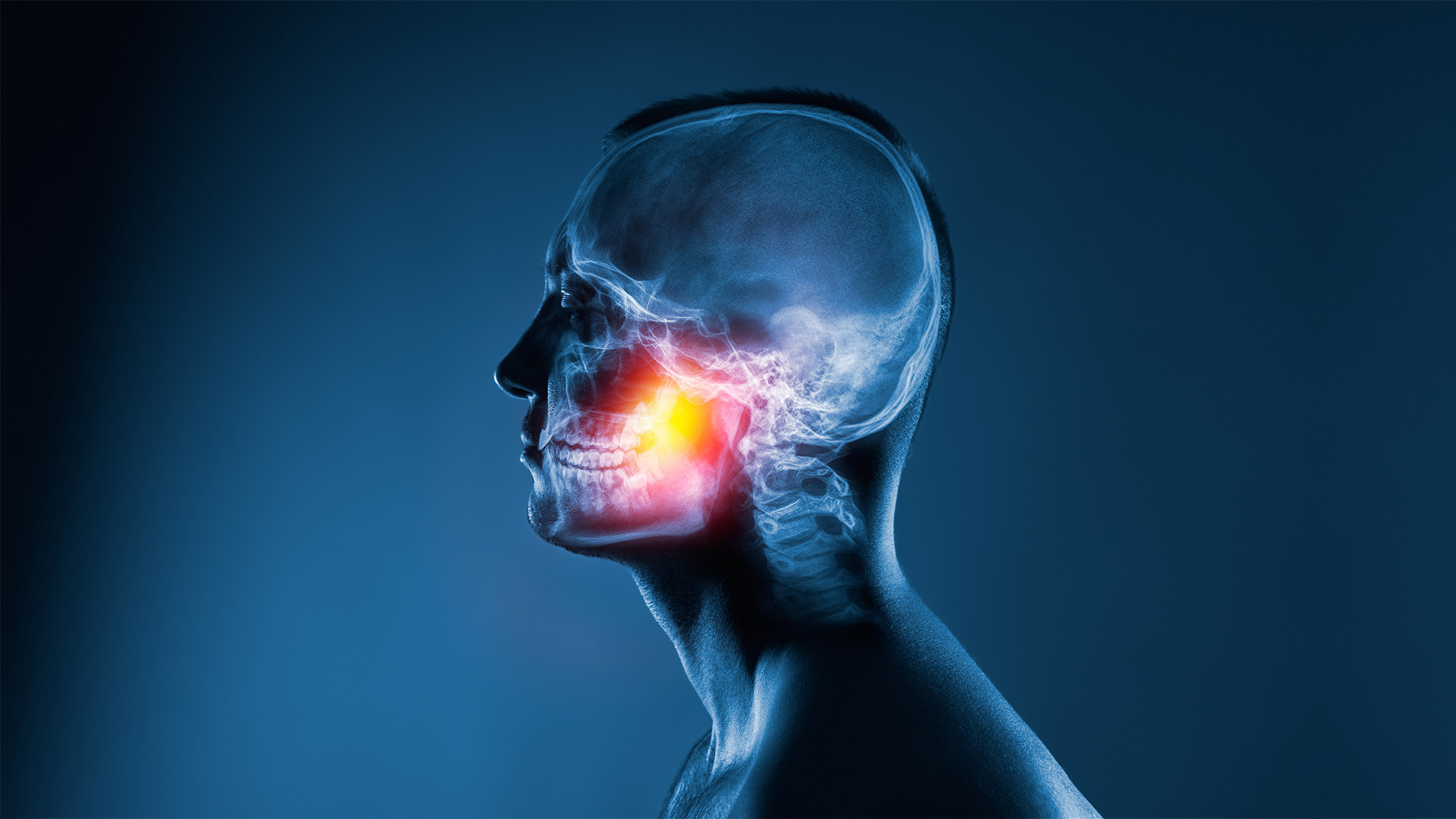 Стоматолог назвал неожиданную причину головной боли