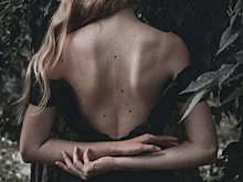 Почему появляются новые родинки и когда стоит беспокоиться