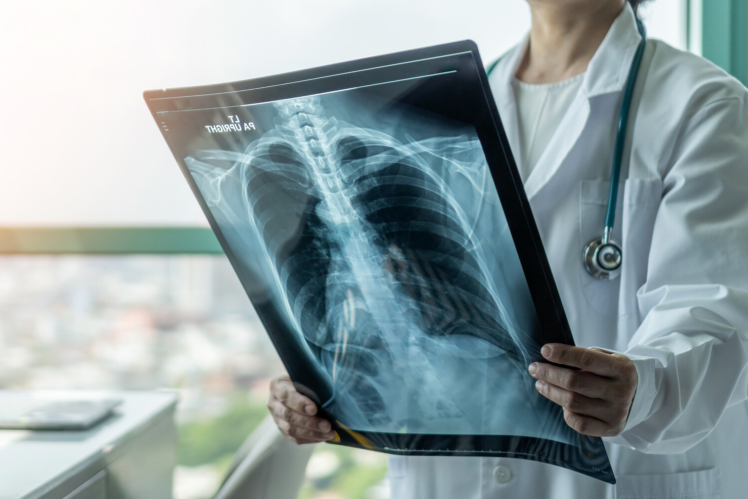 The Lancet: ухудшение функции легких начинается после 20-23 лет - EuroPress.news
