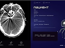 Российские студенты создали симулятор для обучения будущих врачей-рентгенологов