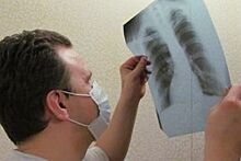 В Новоржеве определились как будут бороться с туберкулезом