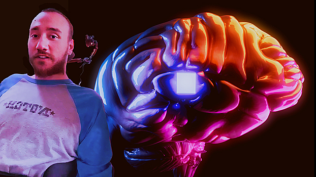 Первый человек с Neuralink: пользуюсь чипом по 10 часов в день и не устаю
