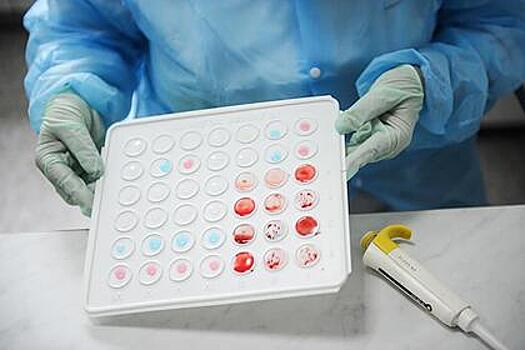 Раскрыта связь группы крови с течением коронавируса