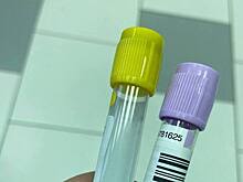 Корью заболело шестьдесят детей в школах и детском саду в столице европейского государства