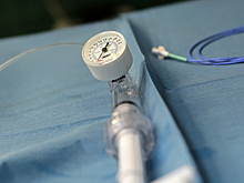 Нейрохирурги спасли пациентку с редкой опухолью спинного мозга