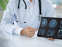 Учёные обнаружили неожиданный бонус популярных лекарств