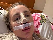 Возлюбленная Владимира Селиванова показала фото до и после пластики: «Кончик ещё опустится»