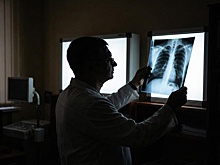 Минздрав утвердил обновленный стандарт медицинской помощи при туберкулезе