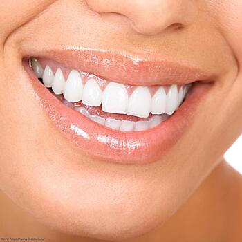 Белоснежная улыбка без вреда для зубов или почему стоит тратиться на качественное отбеливание зубов – рассказывает стоматолог Юлия Сапожникова