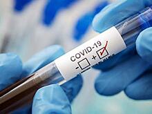 Сергей Дорофеев рассказал о ситуации с COVID-19 в Электрогорске