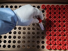 Пандемия COVID-19 сократила заболеваемость гриппом