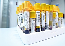 Российскую вакцину от COVID-19 одобрили в Пакистане