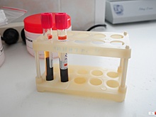 В день памяти жертв СПИДа жители Екатеринбурга смогут бесплатно пройти тест на ВИЧ