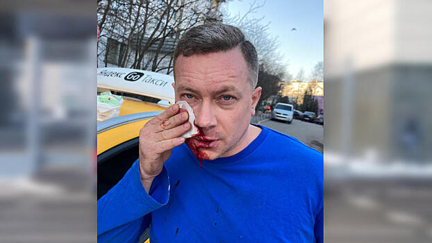 Не поделили дорогу: таксисту изрезали лицо на северо-западе Москвы