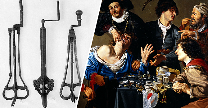 Жуткие стоматологические инструменты прошлого, напоминающие орудия пыток