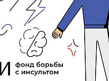 Ковид-ассоциированный инсульт может развиться не только в острой фазе, но и в отсроченном периоде болезни