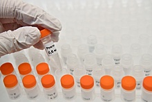 Тесты резидента ОЭЗ «Дубна» помогут диагностировать коронавирус