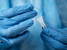 Россельхознадзор оценил риски распространения сибирской язвы после ЧС на Каховской ГЭС