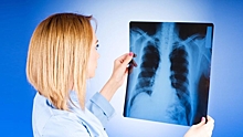 Щербинская городская больница приглашает всех желающих сделать рентгенографию грудной клетки