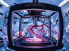 Врачи начали печать на 3D-принтере кровеносные сосуды