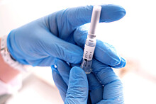 Роспотребнадзор рекомендует прививаться от гриппа через месяц после вакцинации от COVID