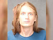 Девочке наложили 19 швов после нападения рэпера с пивной бутылкой