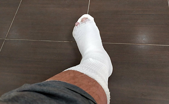 В очередь за костылями встали жители Искитима