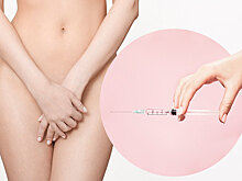 «Я увеличила точку G»: реальная история с комментариями гинеколога