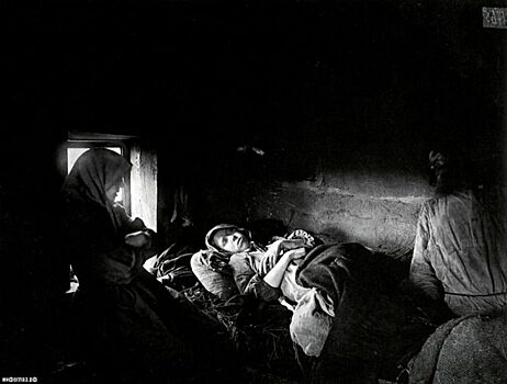 Сифилис: откуда на самом деле взялась эта болезнь