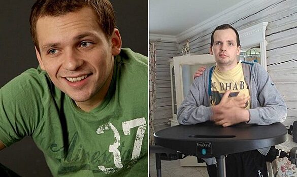 Чудом остались в живых! Артисты, пережившие инсульт