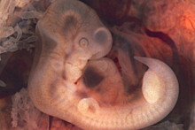 Ученые выяснили, как серотонин влияет на развитие эмбрионов
